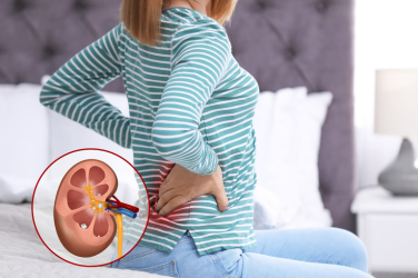 Kidney Stone Treatment